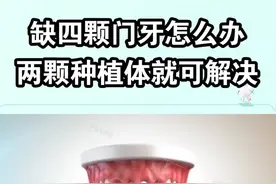 门牙缺失影响面貌，两颗种植牙就可以帮你恢复哦！#抖出新知识 #牙齿🦷 #爱护牙齿 #种植牙视频封面