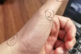 #医学科普 #一起来锻炼 春节骨科小课堂（二），拇指腱鞘炎，如何缓解？进来听听干货吧，欢迎转发，收藏#小技巧 