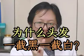 #头发 一截黑一截白这是为什么？视频封面
