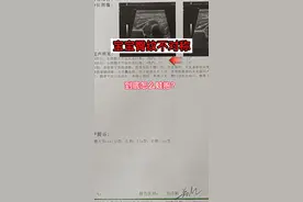 宝宝臀纹不对称，让回家多蛙抱，到底应该怎么抱呢？我手把手教你！#髋关节发育不良 