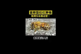 很多人都被#蜜蜂蛰伤过，但不知道怎么处理才是正确的？这个视频可以帮到你#我是头条小百科#dou出新知识#涨知识 视频封面