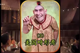 国外男子天生畸形长了三条腿，拥有两套生殖系统，是好还是不好呢视频封面