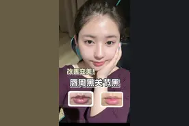唇周黑纹唇，改善关节黑vlog～ #变美小技巧 #唇周黑 #关节黑视频封面