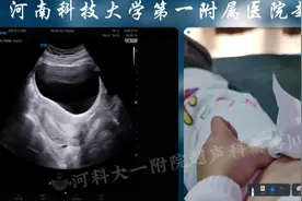 经腹看是否残留及子宫动脉 #超声影像 #每天学习一点点 #医学科普视频封面
